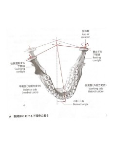 顎関節症1